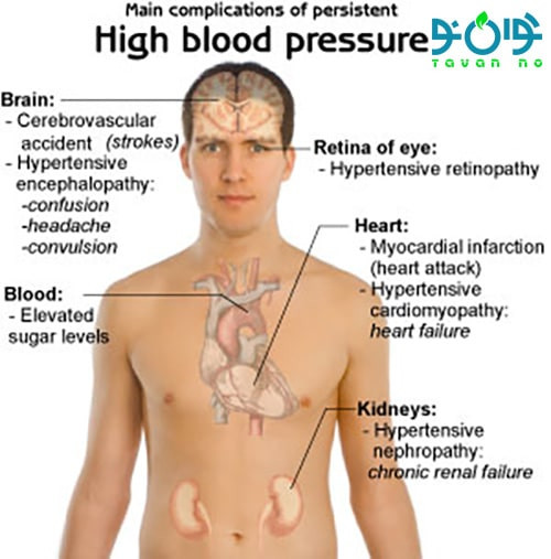 تاثیر فشار خون در جوانان و سالمندان چگونه است-02